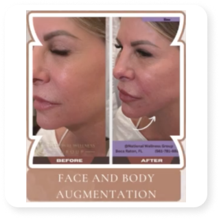 face & body augementation